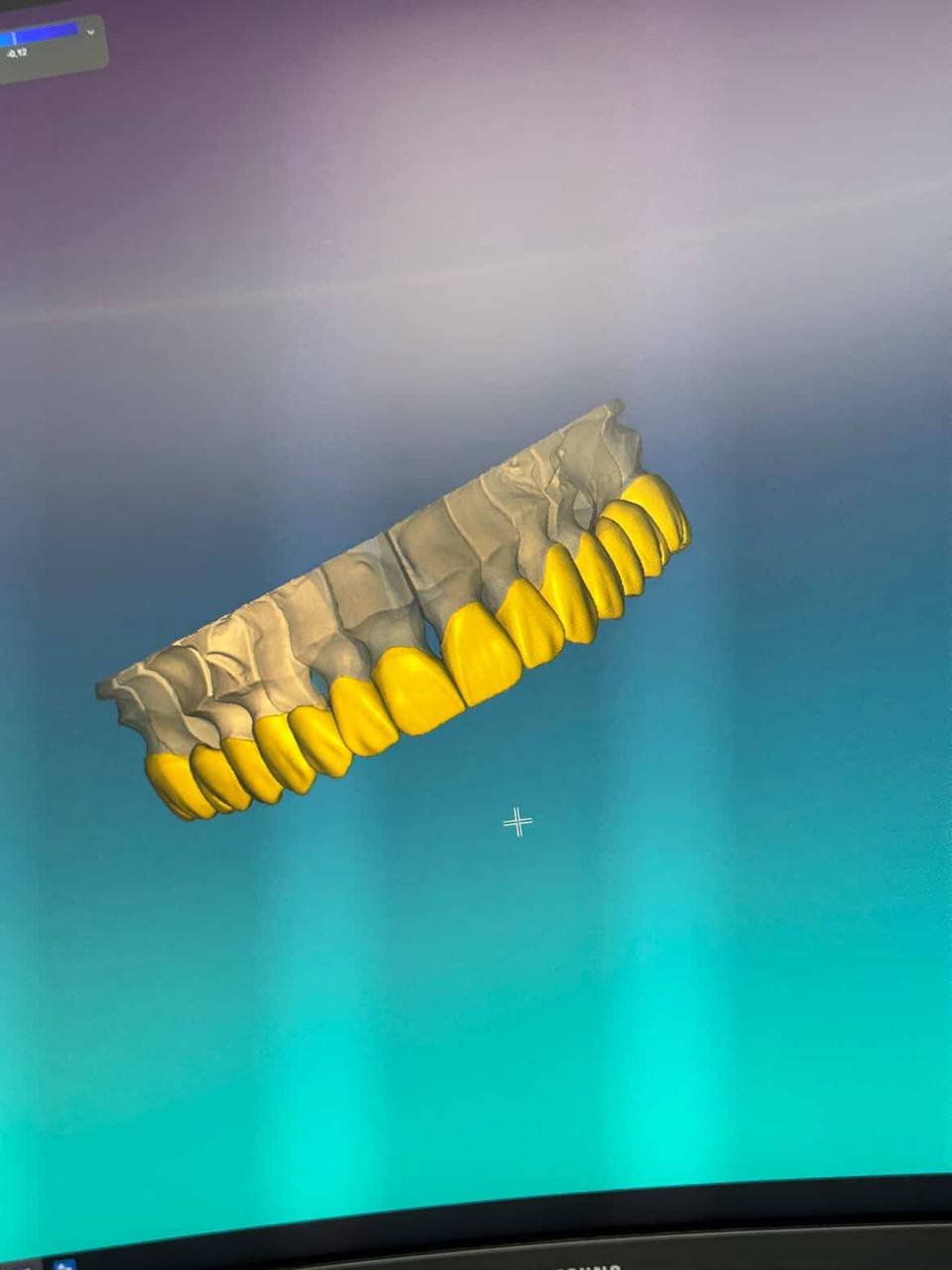 Ատամնաբուժական աշխատանք 4