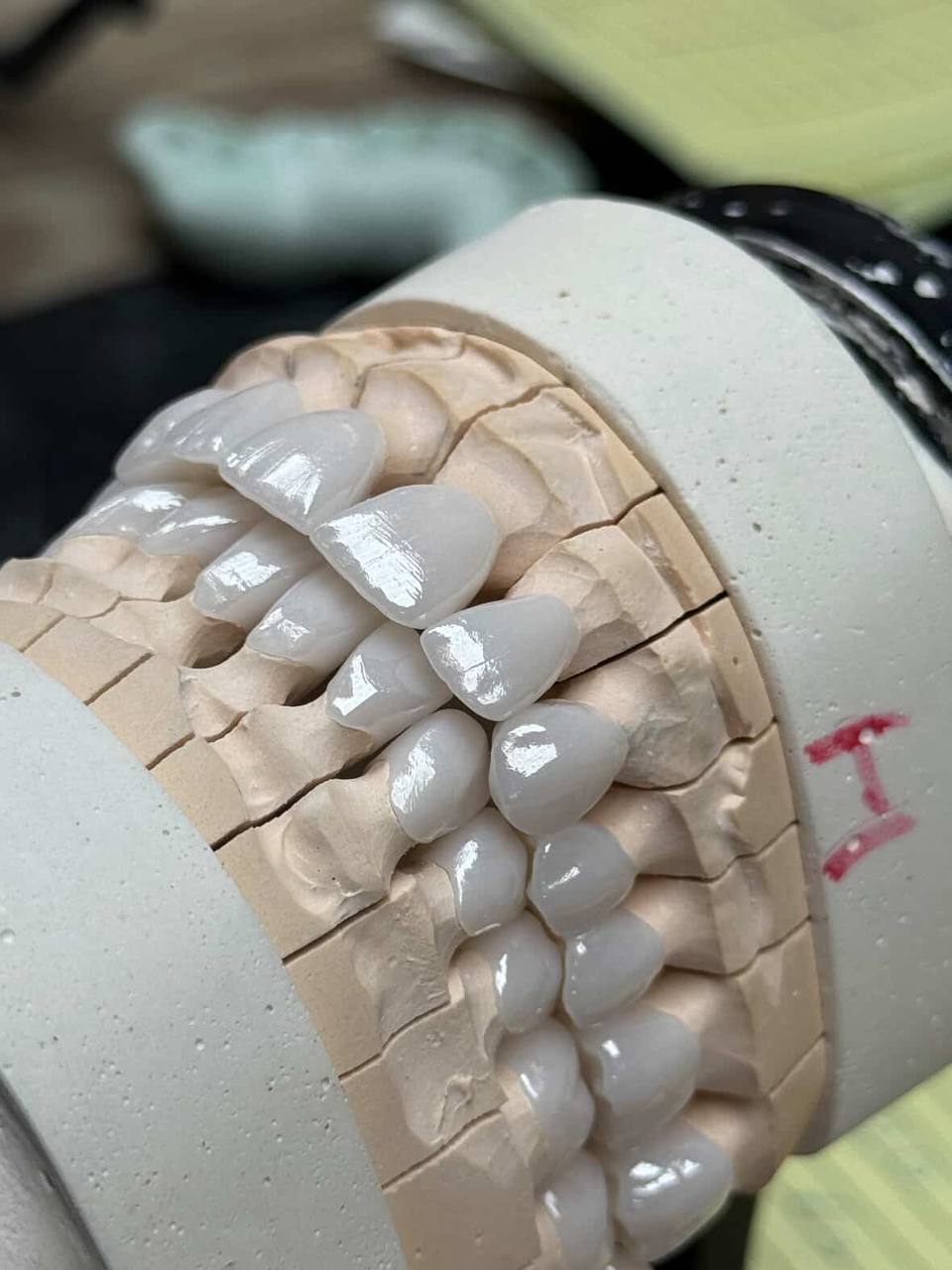 Ատամնաբուժական աշխատանք 4