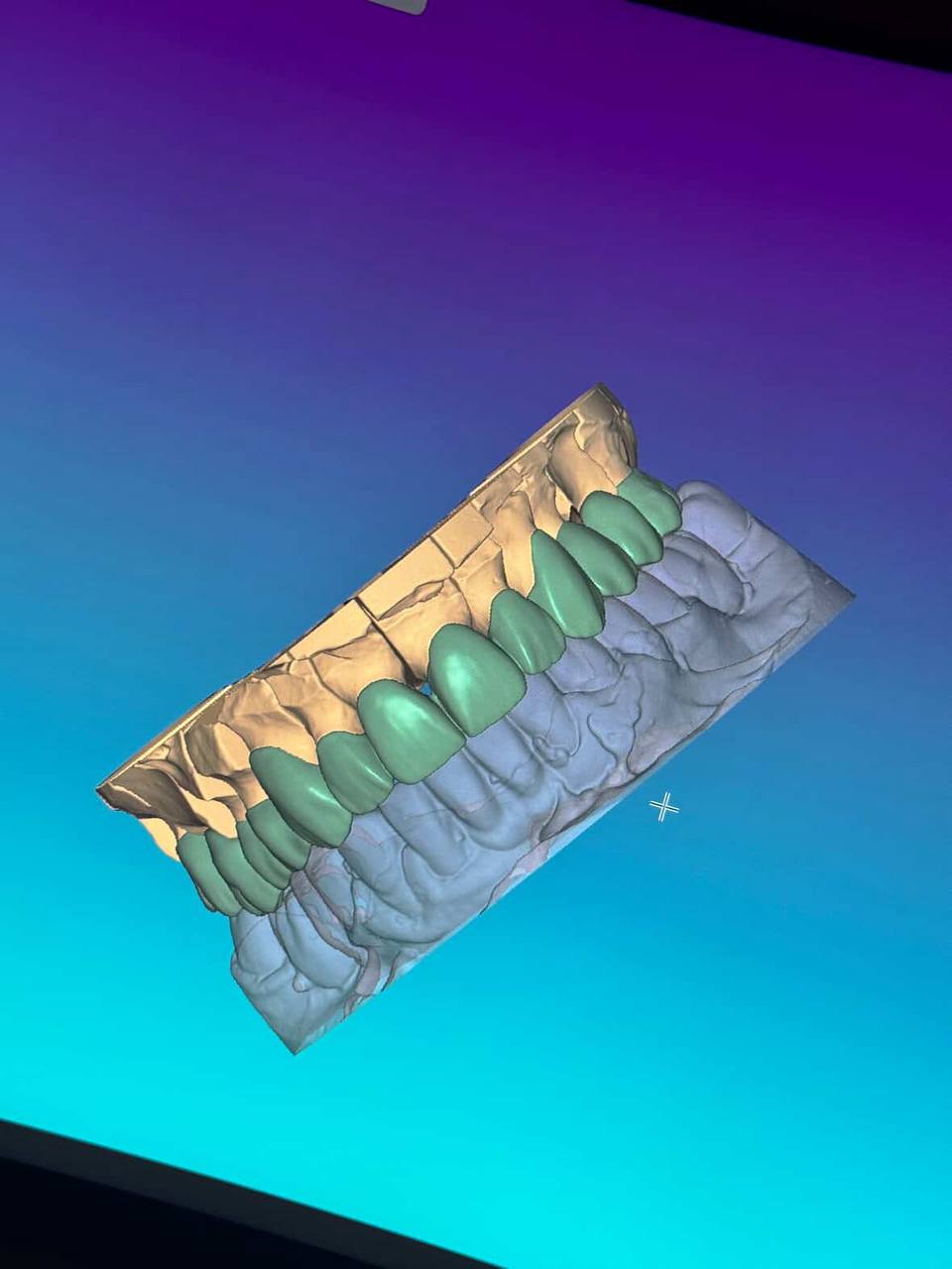 Ատամնաբուժական աշխատանք 4