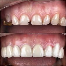 Ատամնաբուժական աշխատանք 1