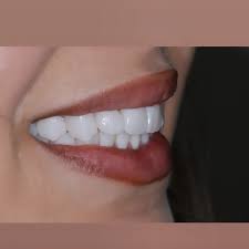 Ատամնաբուժական աշխատանք 2