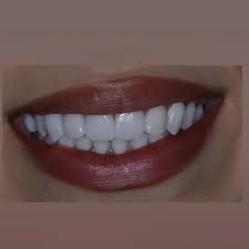 Ատամնաբուժական աշխատանք 3