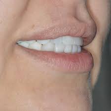 Ատամնաբուժական աշխատանք 4