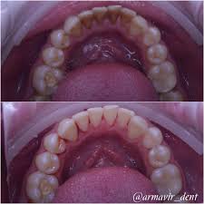 Ատամնաբուժական աշխատանք 4