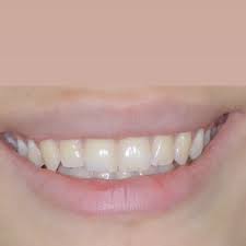 Ատամնաբուժական աշխատանք 4